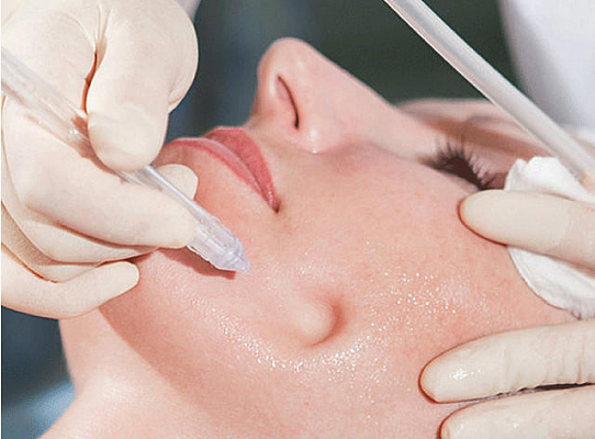 Пилинг лица. Ultra Подарки Красноярск. Подарочный сертификат на натуральную пилинг лица. Ultra Подарки Красноярск. 8 800-505-9503. Пилинг лица  #вМоскве#, чистка лица, очищение лица, химический пилинг