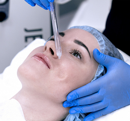 Пилинг лица. Ultra Подарки Красноярск. Подарочный сертификат на натуральную пилинг лица. Ultra Подарки Красноярск. 8 800-505-9503. Пилинг лица  #вМоскве#, чистка лица, очищение лица, химический пилинг